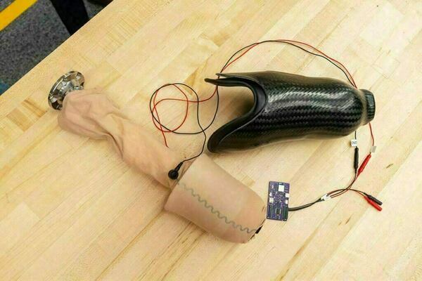 Custom pressure-sensing units embedded in prosthetic sheath.